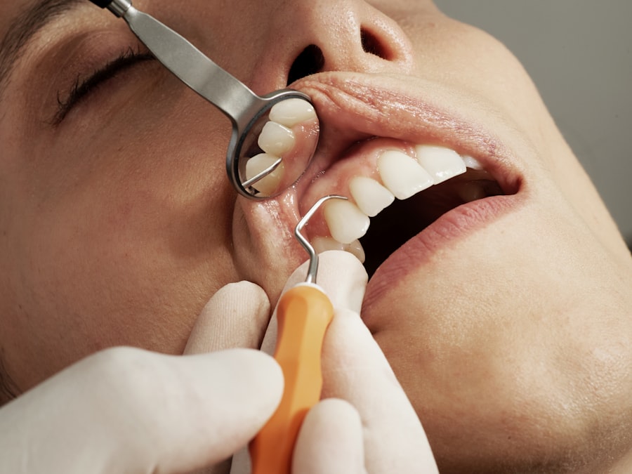 Curso Técnico de Prótese Dentária